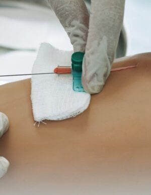 Intravenous (IV) Cannulation