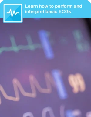 ECG