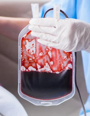 Therapeutic Blood Letting