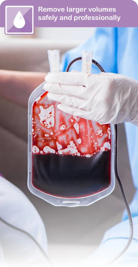 Therapeutic Blood Letting