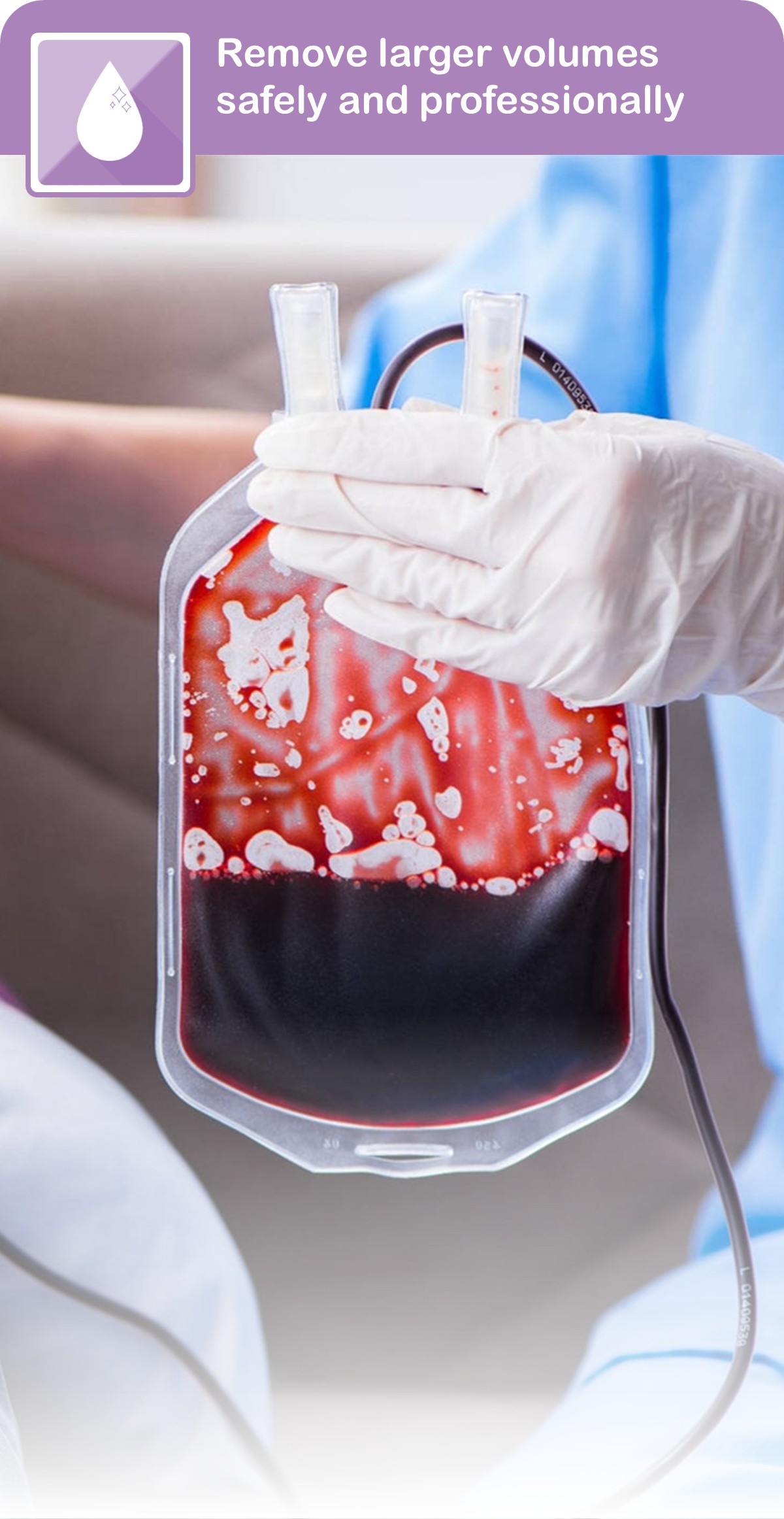 Therapeutic Blood Letting