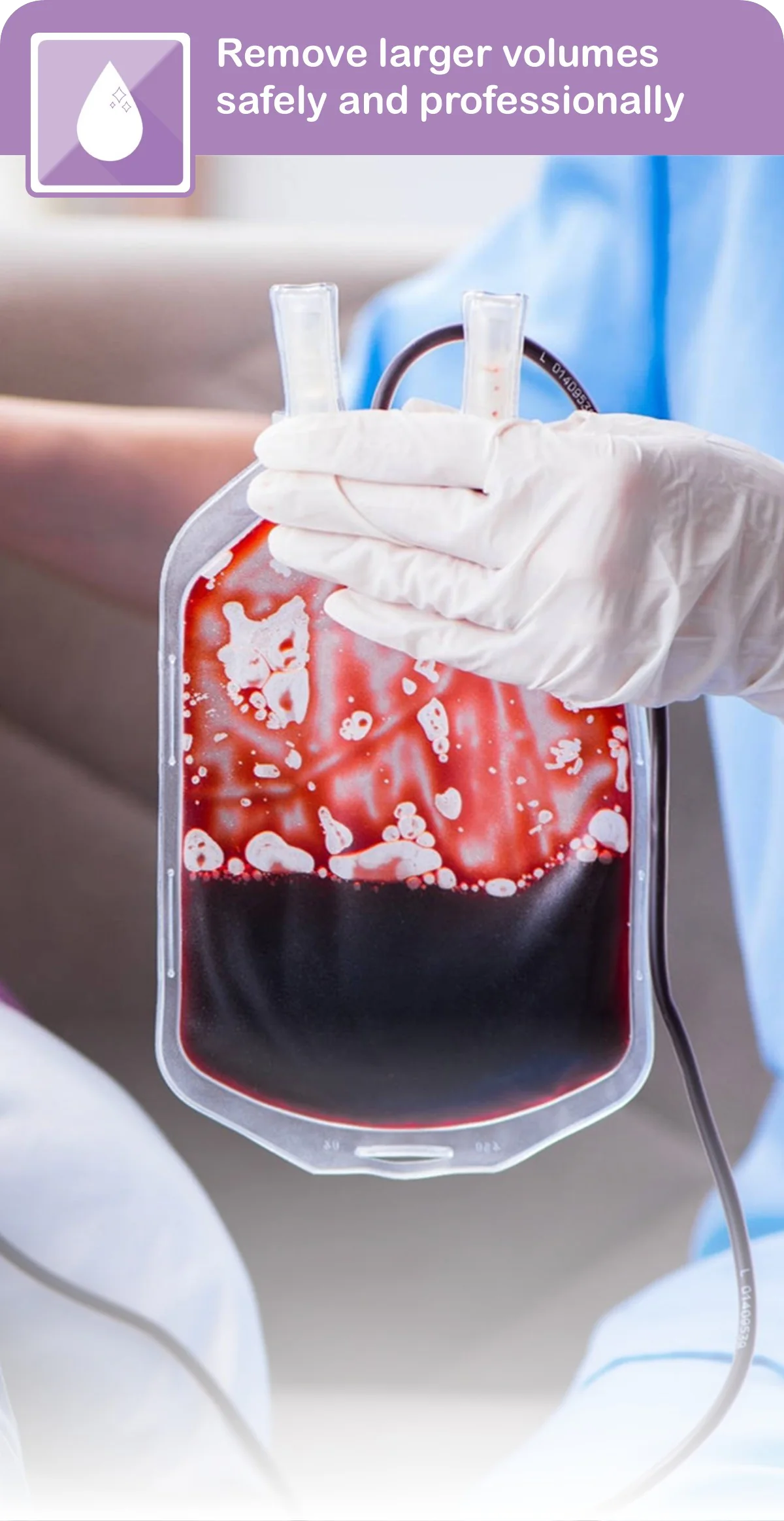 Therapeutic Blood Letting